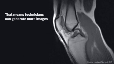 МРТ Визуализация