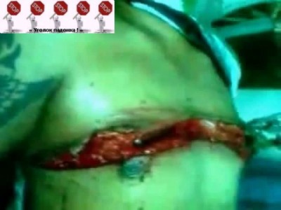 Резанули немножка ...