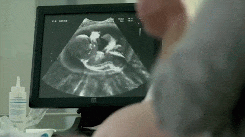 gifs_25