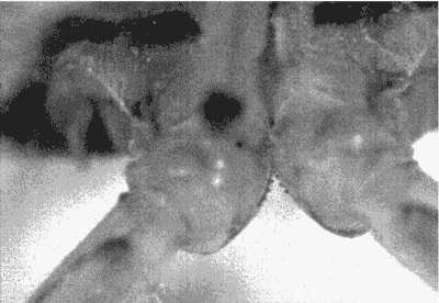 Зубчатая передача у цикад