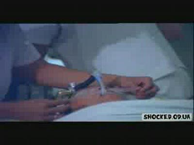 Жесть! Операция по изменению пола. Видео