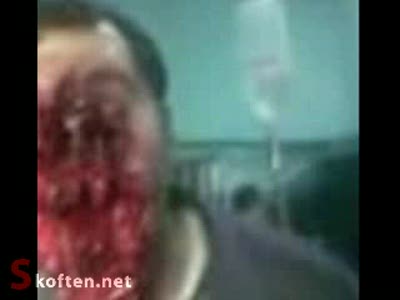 Человек выстрелил себе в лицо