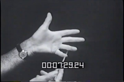 "Трансорбитальная лоботомия", ч.2, Уолтер Фримен