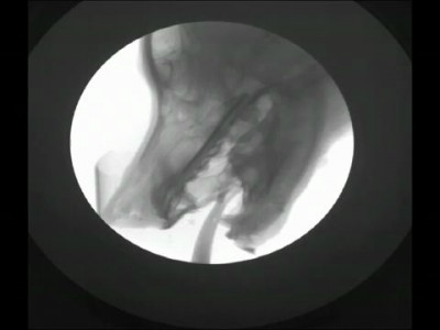 Как пьет собака. рентген