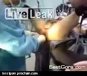 Вынули из жопы