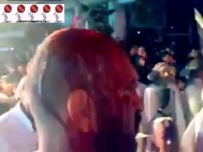 Мозг не задет а остальное пройдёт ...