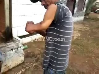 Man Plays with his Broken arm Like a Boss
