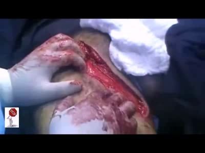 Поранил ногу немного ...