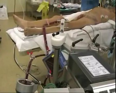 Surgical Implantation of CardioWest™ Total Artificial Heart