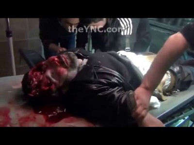 ПОСЛЕ ВЫСТРЕЛА В ГОЛОВУ МУЖЧИНА ЕЩЁ ЖИВ