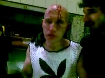 Патриоты поймали лысого парня