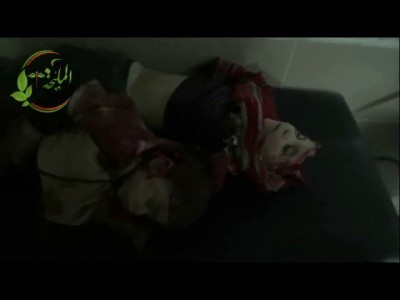 Inside of a Syrian Emergency Room reveals Faceless Man somehow still Alive