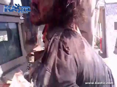 Mans Ass Violated And His Head Completely Ripped Open