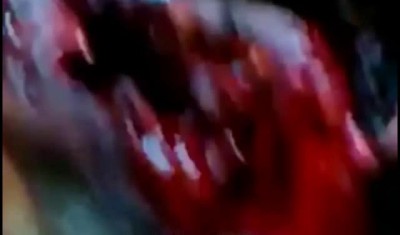 Пуля в горле