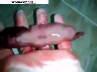 4-месячный плод ...