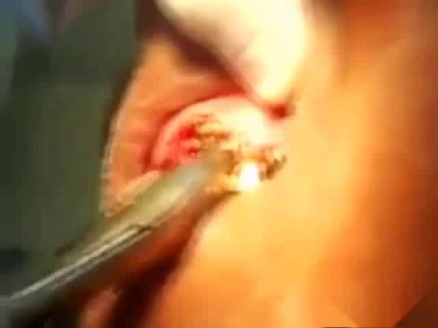 Неприятный запах изо рта