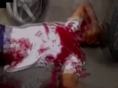 Небольшая подборка раненых ...