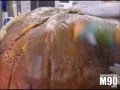 Хирурги удалить 132 фунтов мошонки у мужчины